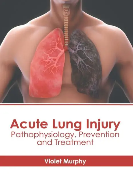 Acute Lung Injury: Pathophysiology, Prevention and Treatment Top Pick